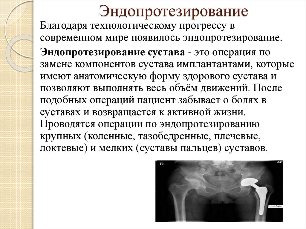 Заболевания опорно двигательного аппарата презентации