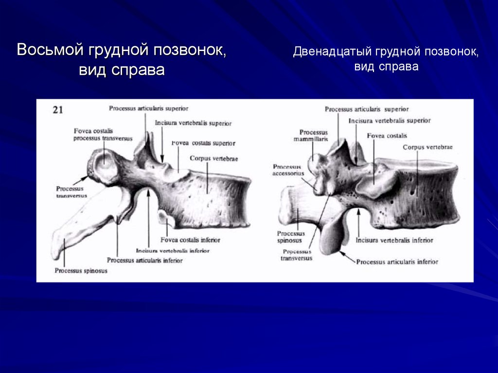 Цервикобрахиалгия справа на фоне шейного