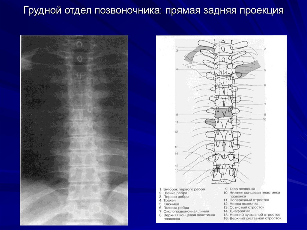 Грудные позвонки фото