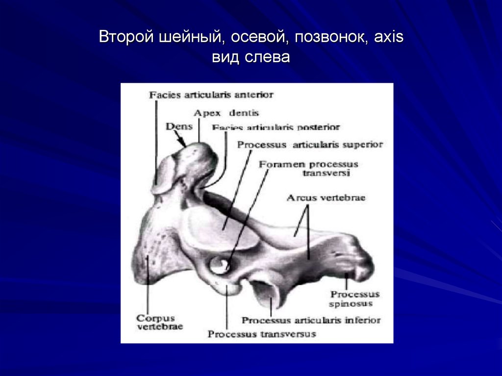 2 шейный позвоночник. Аксис шейный позвонок. Осевой позвонок Аксис. Ахис второй шейный позвонок. Второй шейный позвонок Аксис вид.