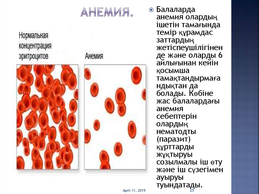 Включи анемия. Средняя степень анемии эритроциты. Малокровие презентация. Анемия картинки.