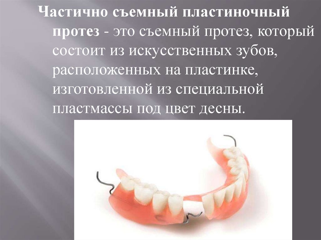 Съемный пластиночный протез показания. Пластиночные протезы ортопедическая стоматология. Съёмный пластиночный протез состоит из:. Частичный съёмный пластиногчный протез. Частичный съемный пластинчатый протез.