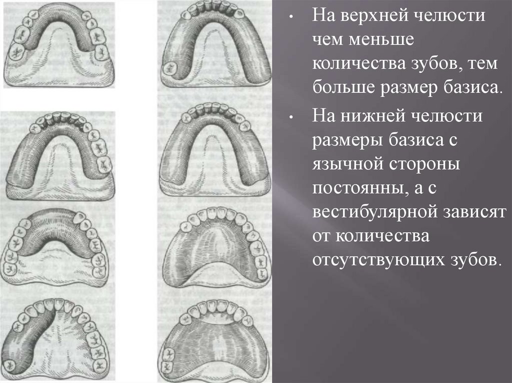 Зона податливости слизистой оболочки. Границы базиса съемного пластиночного протеза на нижнюю челюсть. Границы базиса на верхней челюсти. Границы металлического базиса беззубой нижней челюсти. Базис частичного съемного пластиночного протеза.