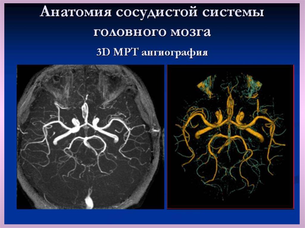 Интракраниальные артерии головного мозга. Кровообращение мозга. Виллизиев круг.. Мрт ангиография сосудов головного мозга анатомия. Кт ангиография сосудов головного мозга анатомия. Сосуды головного мозга на кт анатомия.