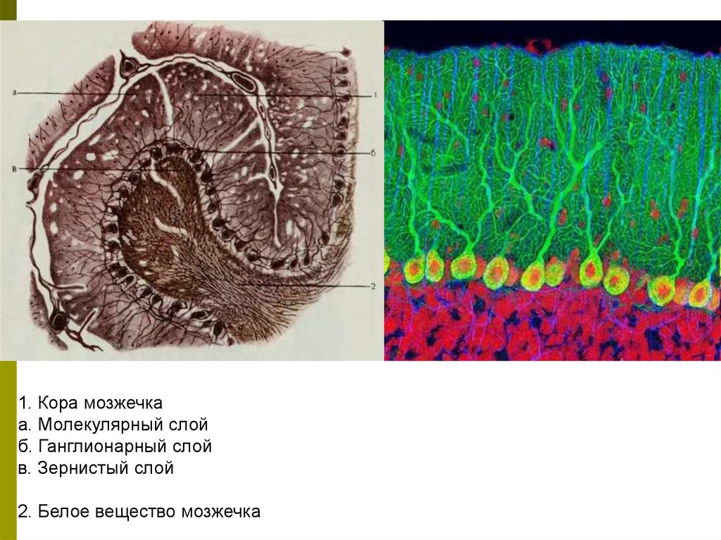 Ткань мозжечка. Мозжечок гистология препарат. Нейроны мозжечка гистология. Гистологическое строение мозжечка гистология.