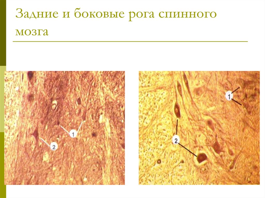 Спинной мозг гистология рисунок