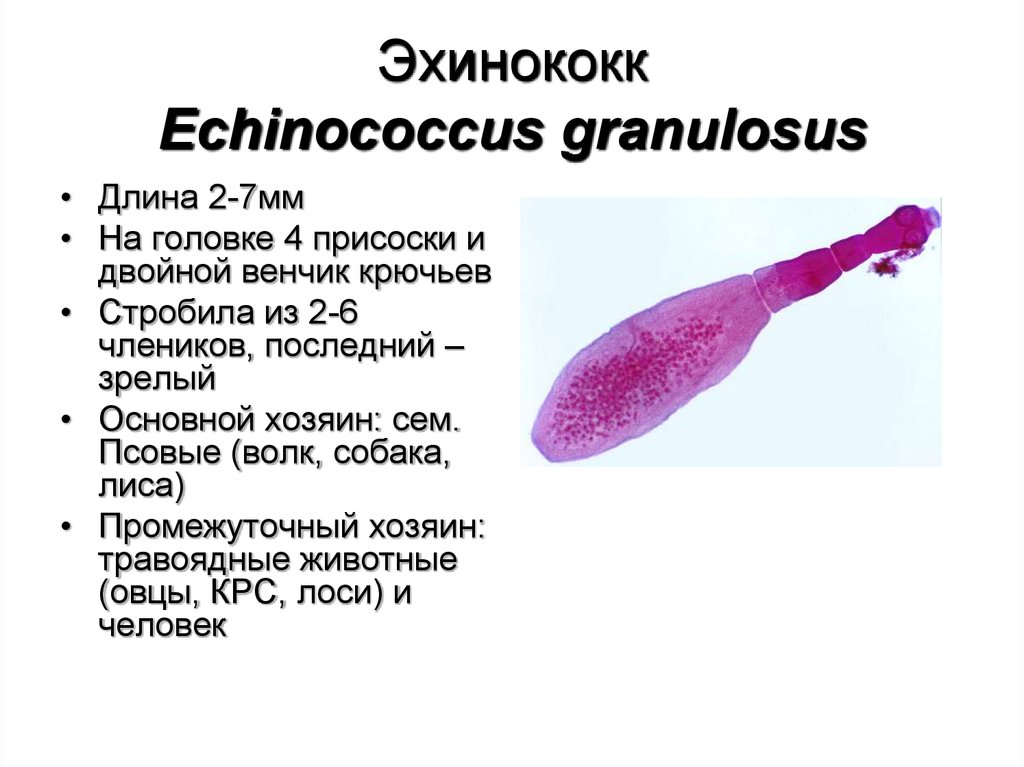 Чем опасен эхинококк для человека. Эхинококкоз печени морфология. Нервная система эхинококка. Изучение морфологии эхинококка.. Эхинококк строение.