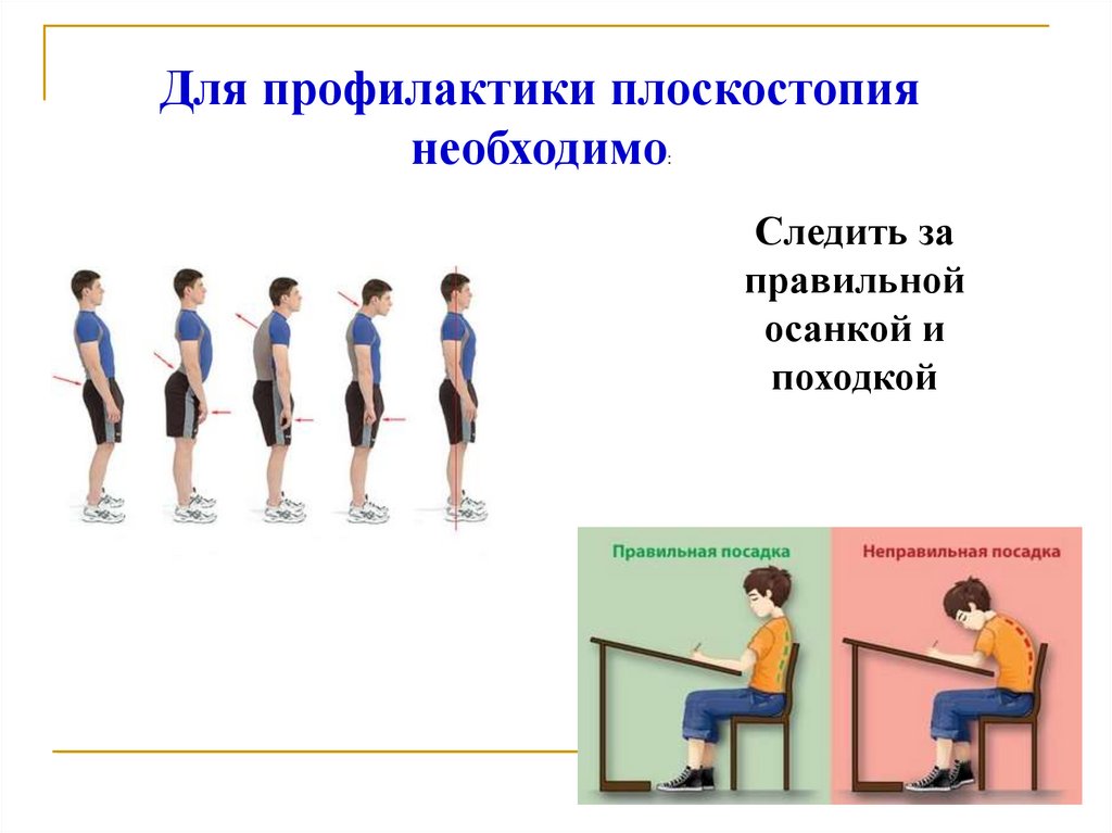 Формирование осанки и профилактика плоскостопия. Вывод осанка и плоскостопие. Здоровьесберегающая технология профилактика плоскостопия. Осанка заключение. Выносные лотки на улицу для профилактики плоскостопия.