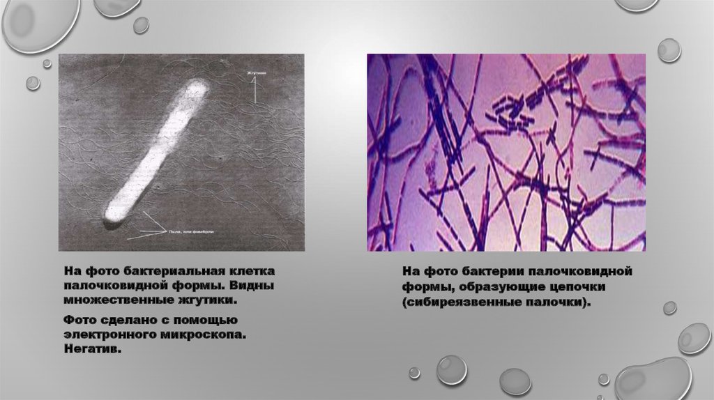 Вижу бактерии. Палочковидные формы бактерий. А) формы палочковидных клеток бактерий. Жгутики бактерий микроскоп. Палочкой видные бактерии.