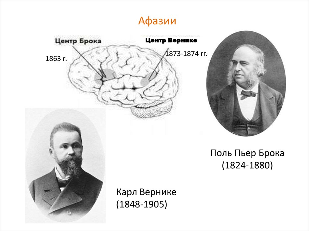 Поль брока. Поль Брока 1824-1880. Поль Пьер Брока. Брока и Вернике ученые.