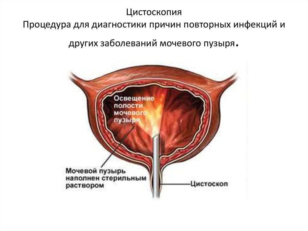 Цистоскопия в новосибирске