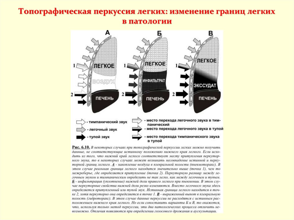 Топографическая перкуссия легких границы