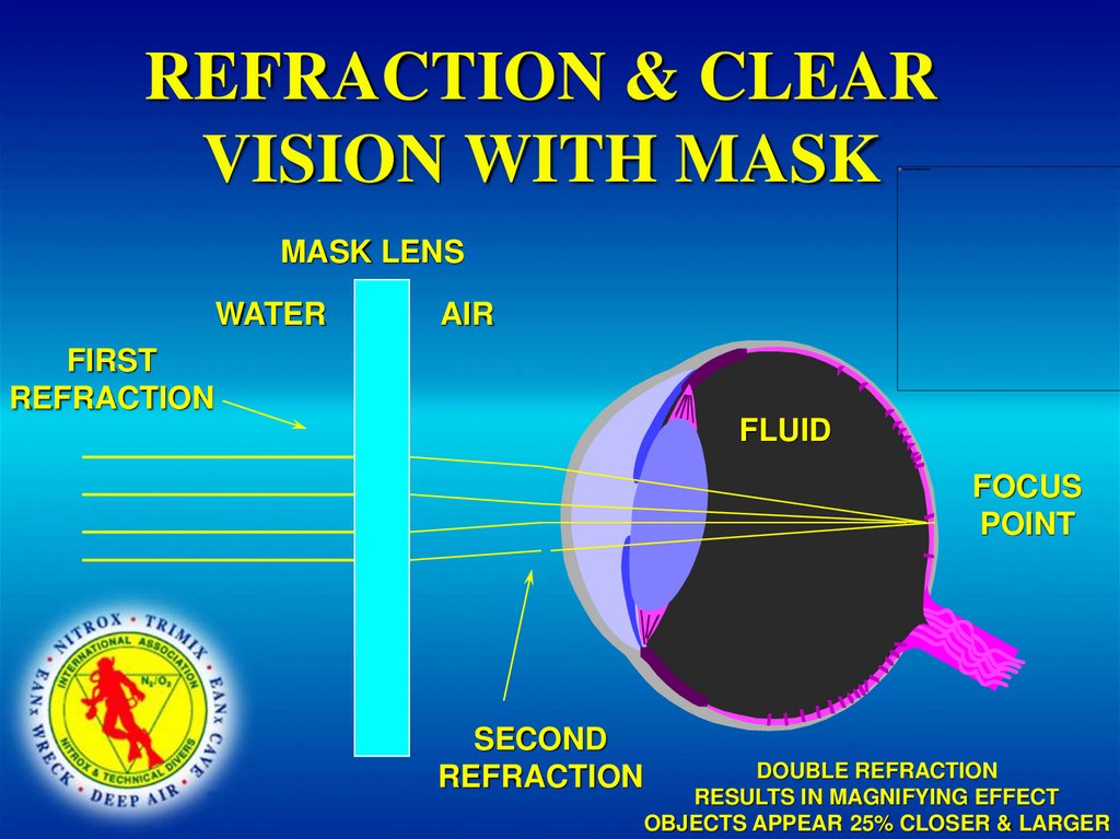 REFRACTION & CLEAR VISION WITH MASK