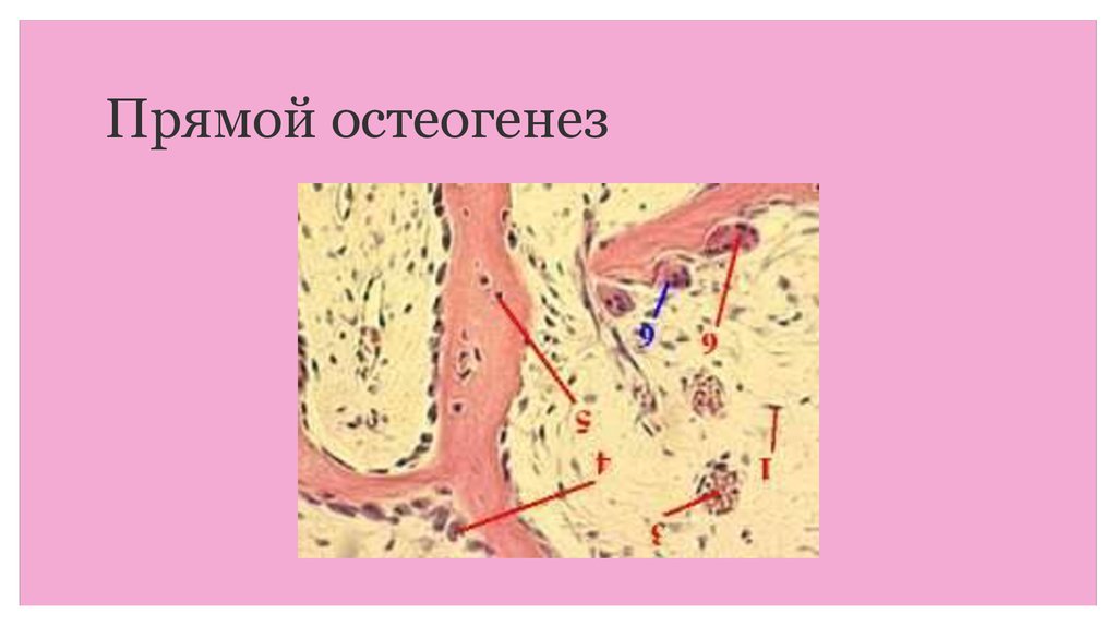 Непрямой остеогенез схема