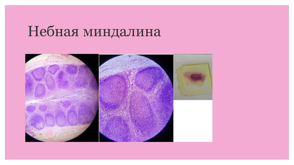 Миндалина гистология рисунок