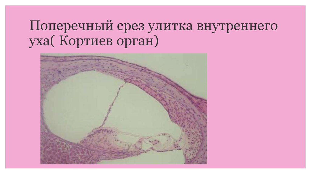 Схема поперечного среза улитки