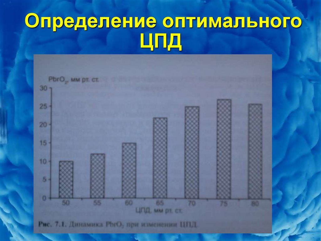 Цпд. ЦПД заключение психолога. ЦПД В МВД. ЦПД расшифровка. Анкета на ЦПД.