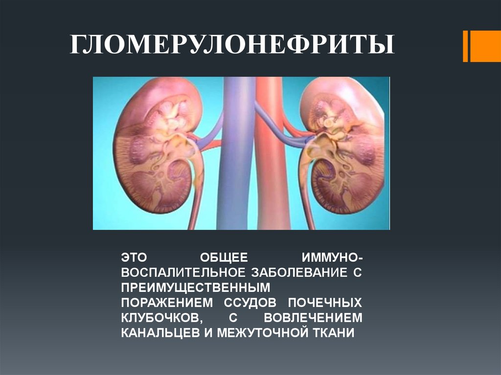ГЛОМЕРУЛОНЕФРИТЫ