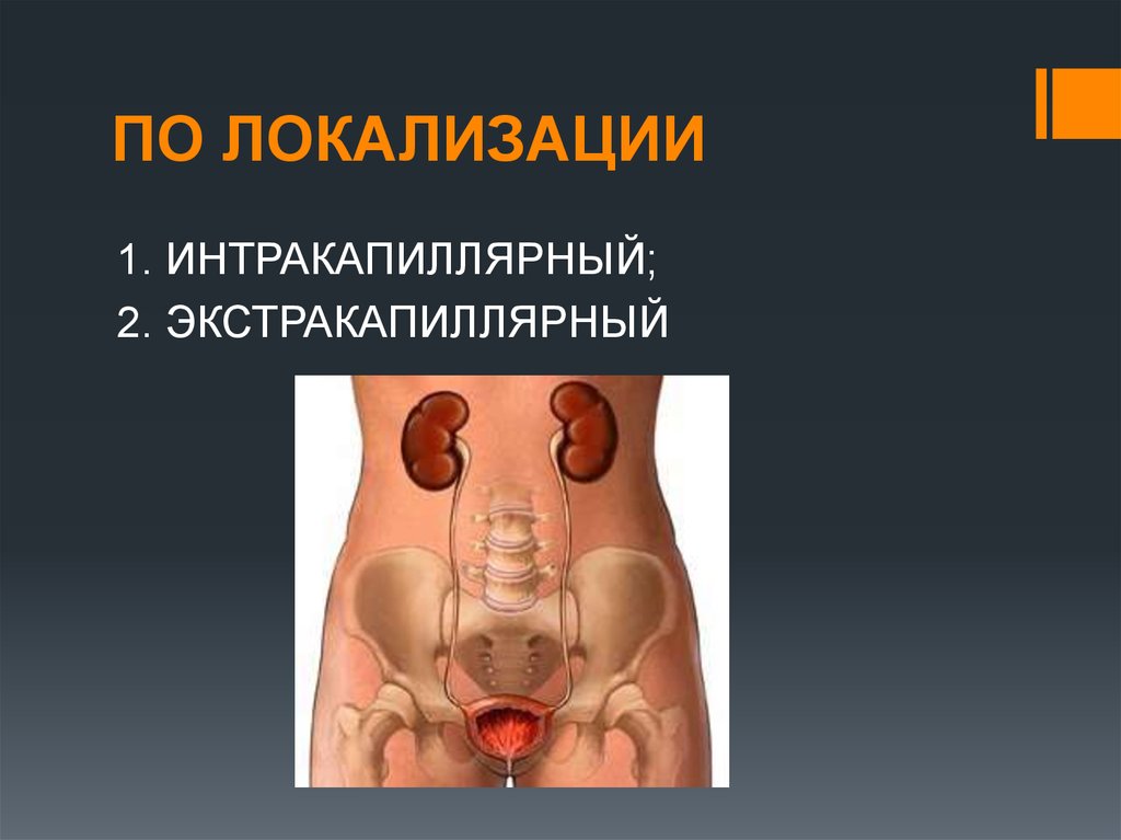 ПО ЛОКАЛИЗАЦИИ