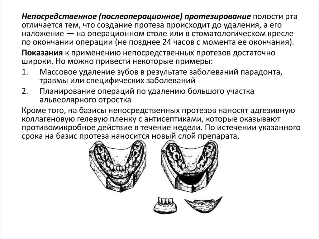 Резекция верхней челюсти презентация