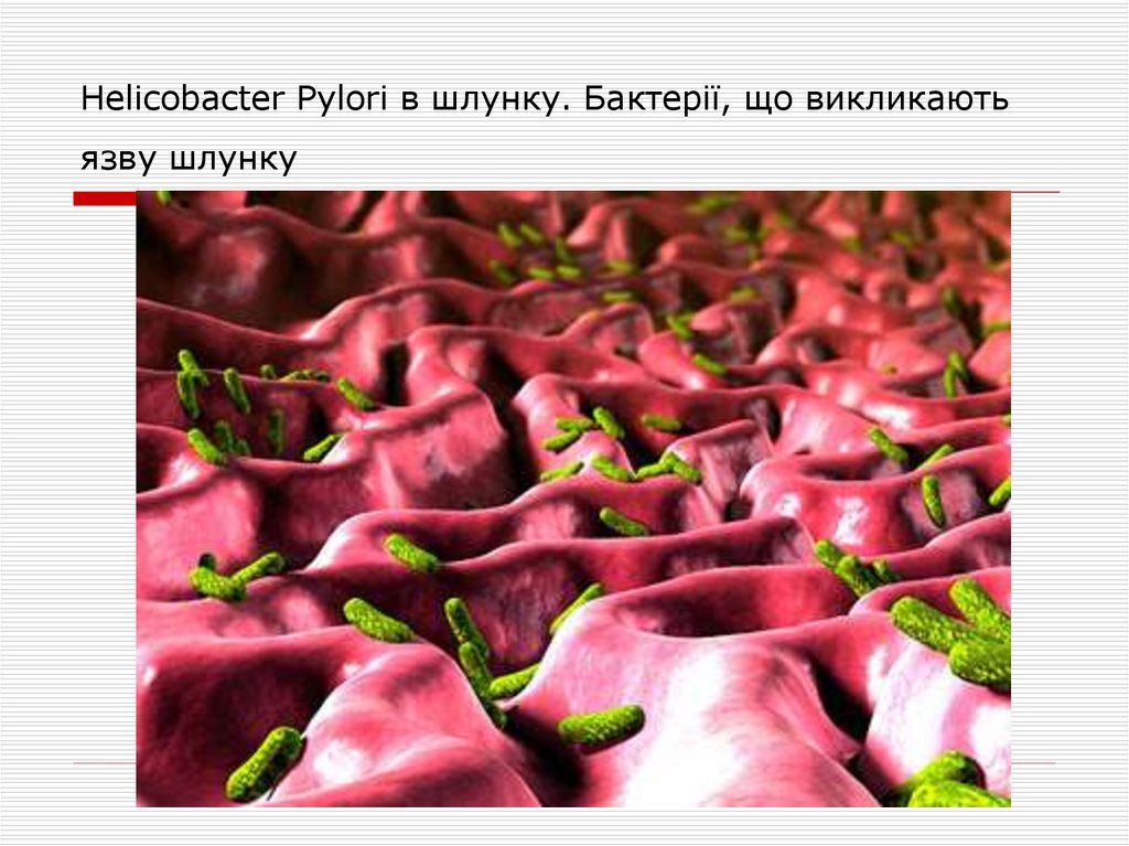 Helicobacter Pylori в шлунку. Бактерії, що викликають язву шлунку