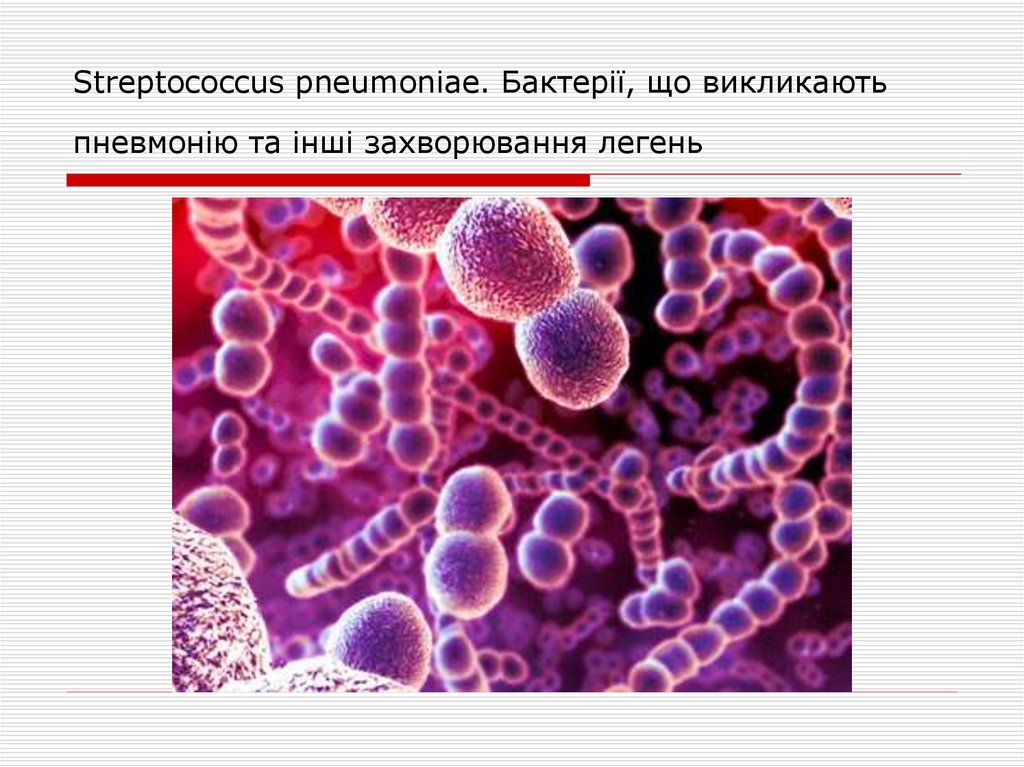 Streptococcus pneumoniae. Бактерії, що викликають пневмонію та інші захворювання легень