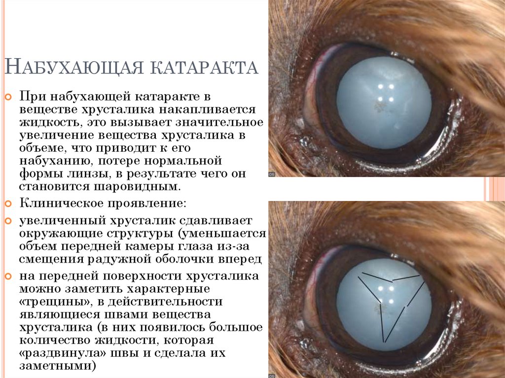 Фото глазных болезней с описанием