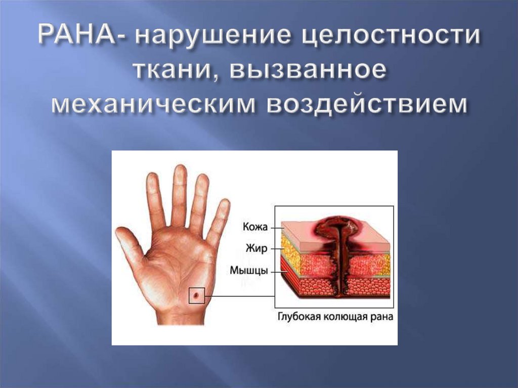 Раны картинки для презентации