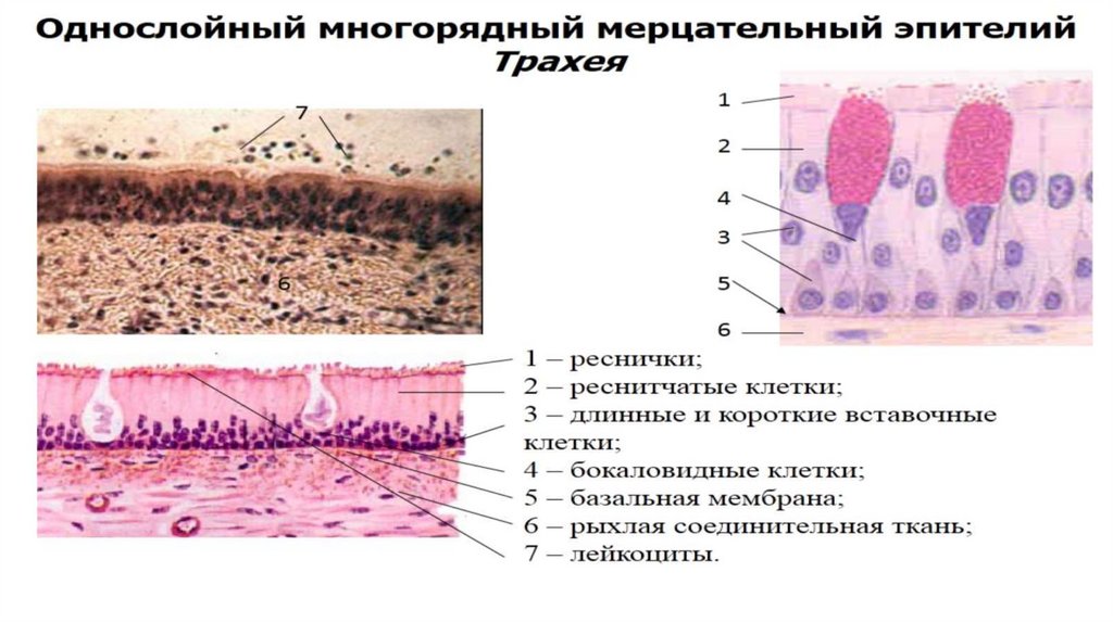 Эпителиальные клетки какая норма. Многослойный неороговевающий эпителий. Эпителиальная ткань лекция. Опухоли из эпителиальной ткани. Эпителиальные клетки кожи.