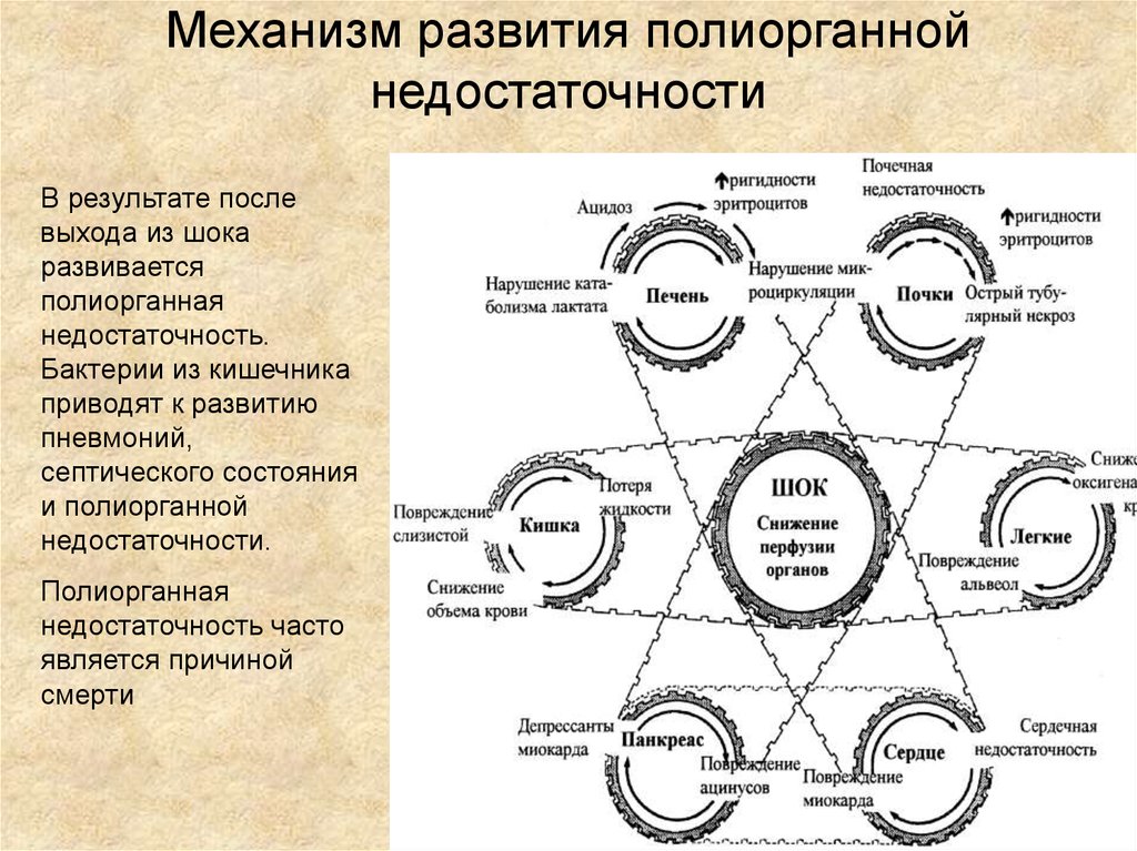 Механизмом развития является развитие. Полиорганная недостаточность механизм развития. Патогенез полиорганной недостаточности схема. Механизмы развития синдрома полиорганной недостаточности. Полиоргвнная недостаточно.