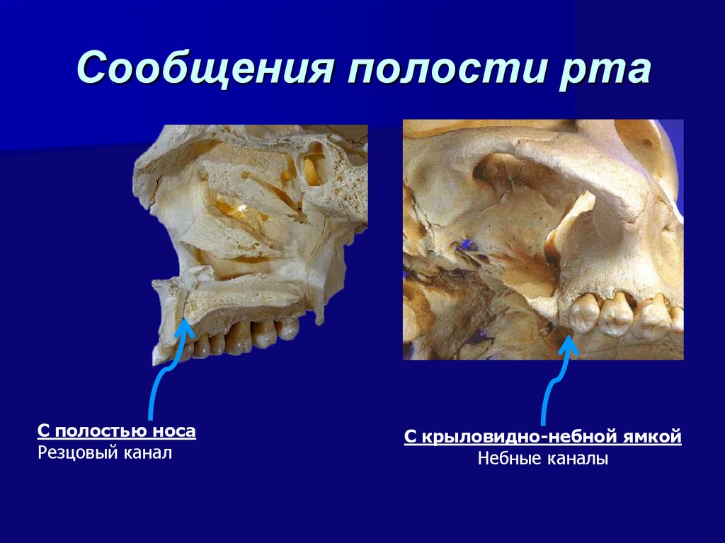 Костная основа полости рта. Сообщения ротовой полости. Крыловидно-небная ямка сообщается с полостью носа через.