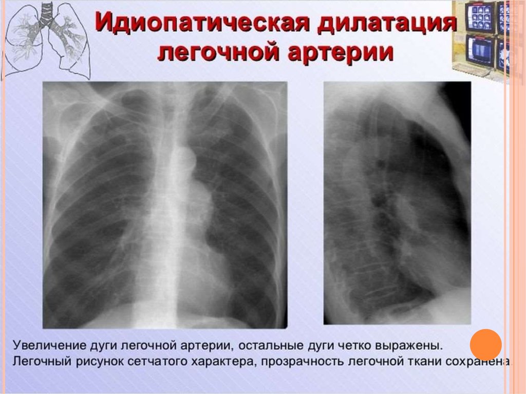 Лучевая диагностика органов средостения презентация