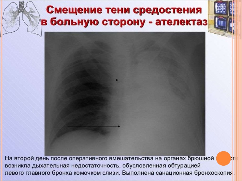 Лучевая диагностика средостения презентация