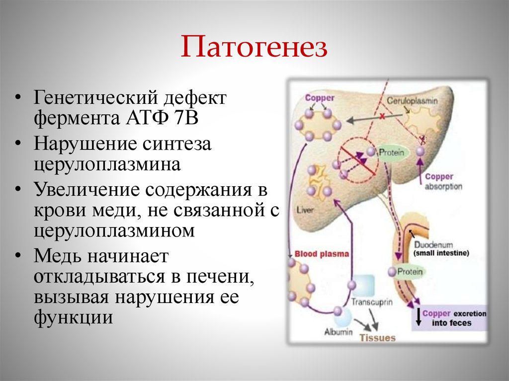 Патогенез ожоговой болезни схема