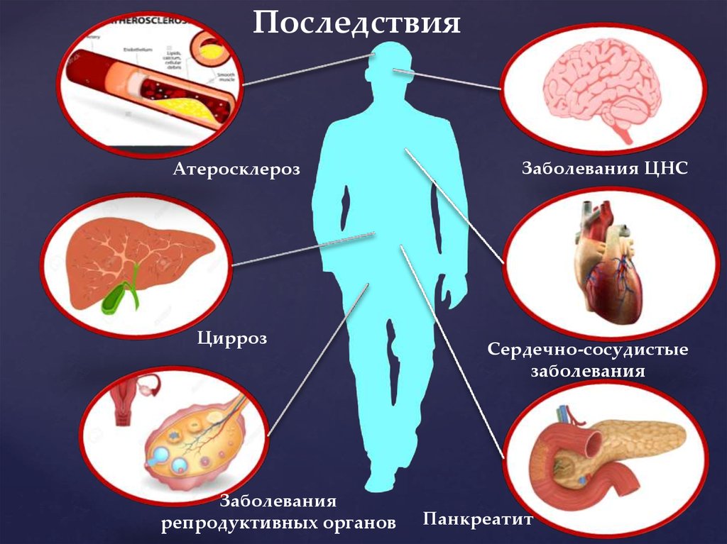 Последствия заболевания