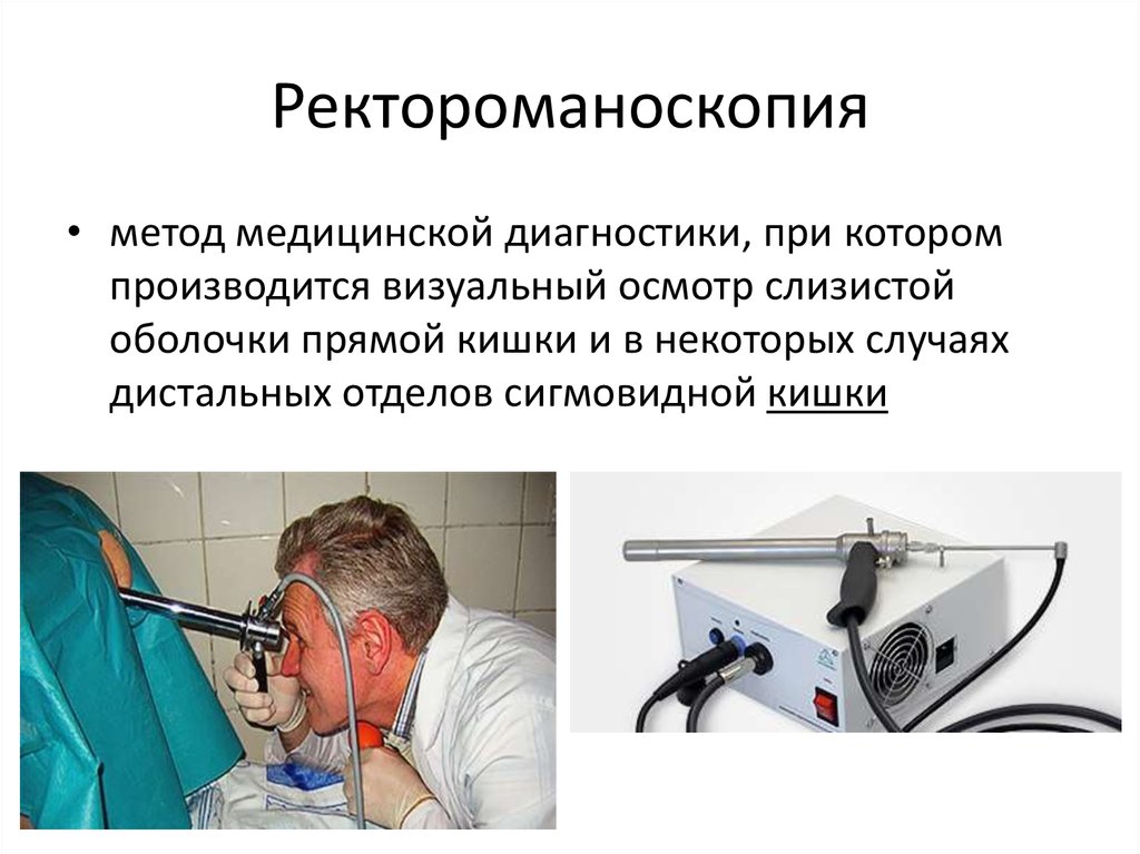 Клиническая проктология. Ректороманоскопия это метод исследования. Исследование прямой кишки ректороманоскопия. Исследование прямой кишки ректоскопия. Ректороманоскопия ход исследования.