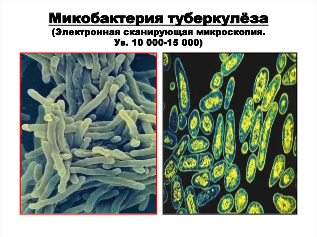 Микобактерии методы микроскопии