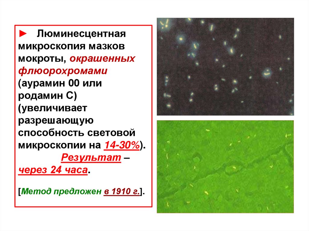 Микобактерии анализ. Люминесцентная микроскопия микробиология. Микобактерии люминесцентная микроскопия. Люминесцентная микроскопия туберкулеза. Микобактерии туберкулеза люминесцентная микроскопия.