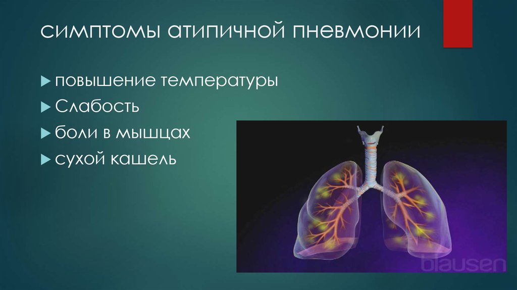 симптомы атипичной пневмонии