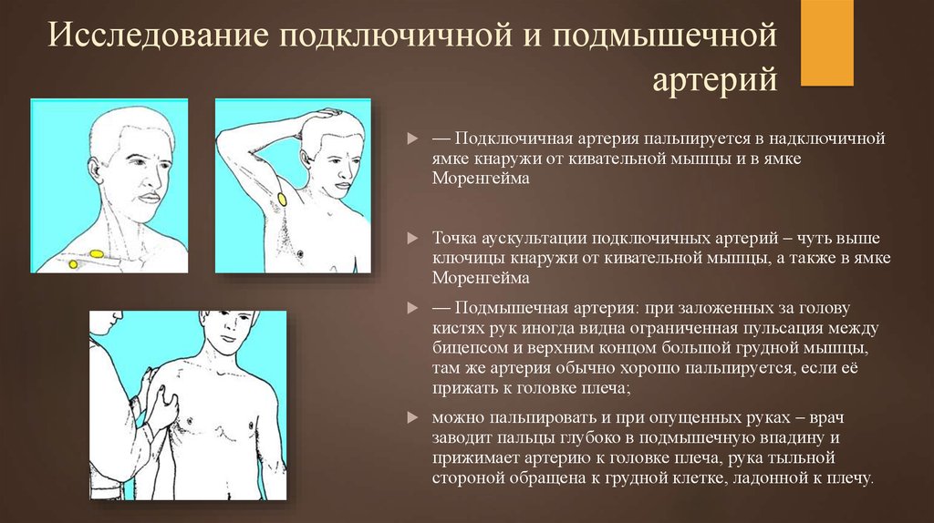 Подключичный тромбоз. Исследование подключичной артерии. Пальпация подключичной артерии. Пальпация надключичной ямки. Подключичная ямка.