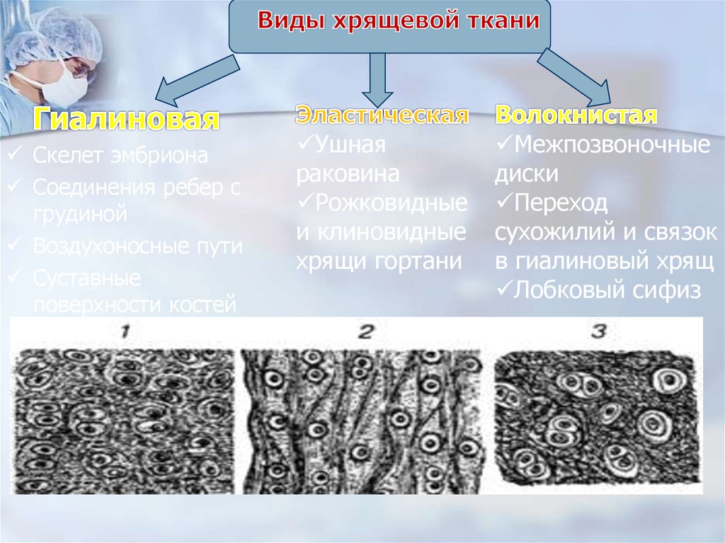 Гиалиновый волокнистый эластический хрящ таблица. Типы хрящевой ткани гистология. Гиалиновый вид хрящевой ткани. Гиалиновая хрящевая ткань таблица.