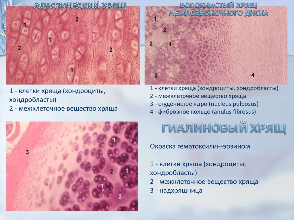 Хрящ образован. Волокнистый хрящ препарат гистология. Строение волокнистого хряща гистология. Гиалиновый хрящ межпозвоночного диска. Эластический хрящ гистология.
