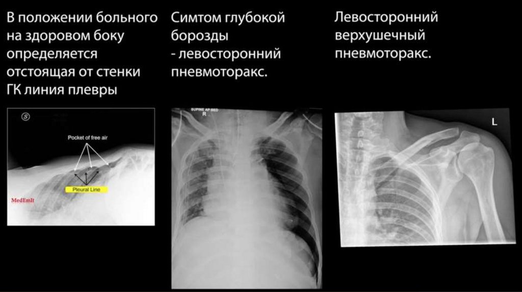 Можно ли выжить после огнестрельного ранения