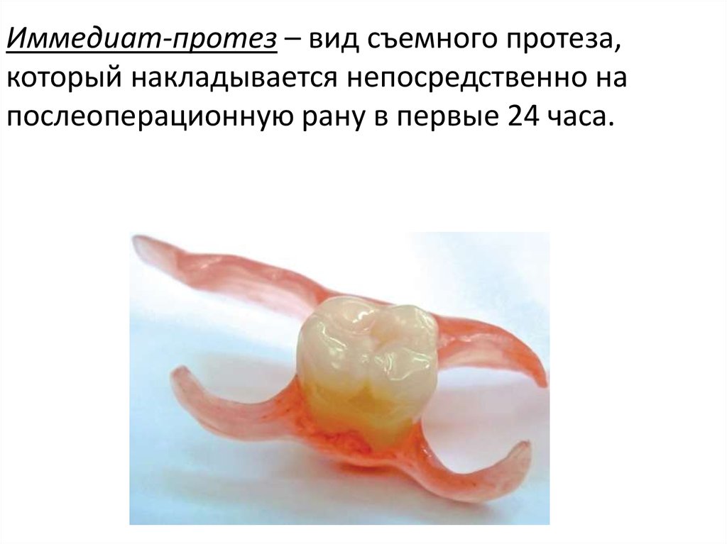 Протезирование у детей презентация