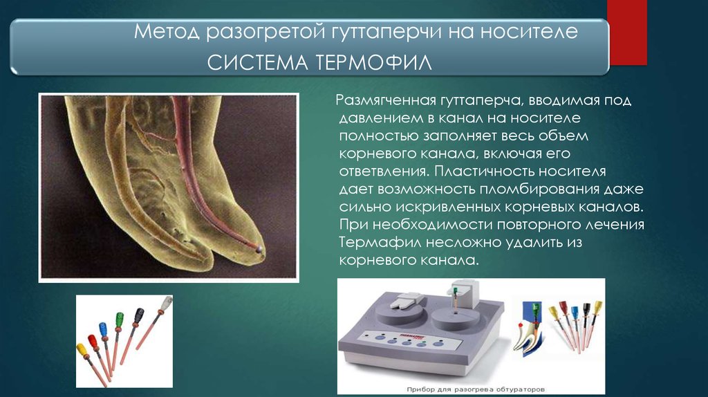 Методики обтурации корневых каналов презентация