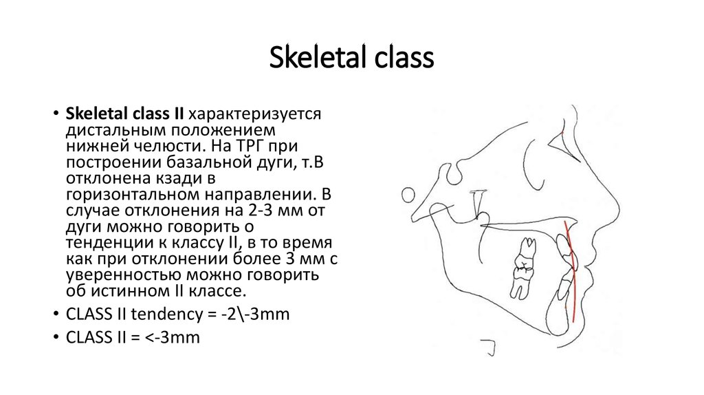 Skeletal class