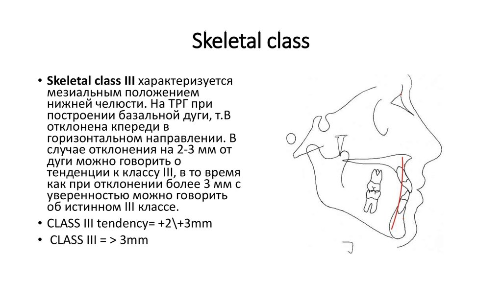 Skeletal class