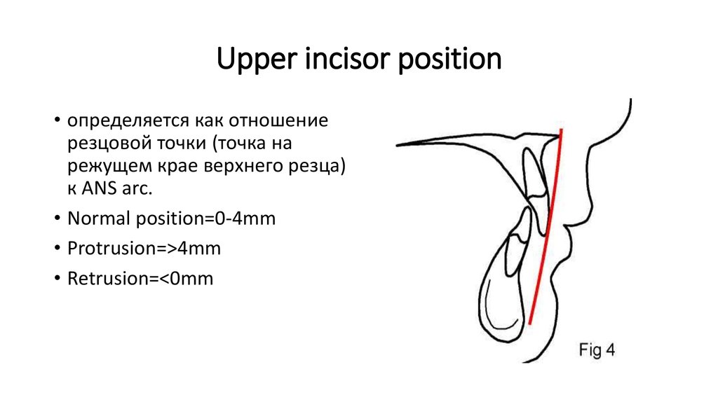 Upper incisor position