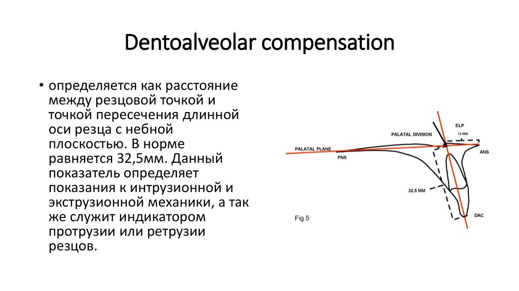 Dentoalveolar compensation