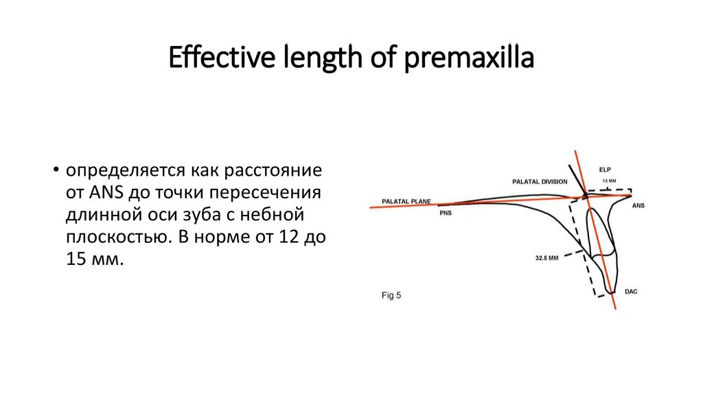 Effective length of premaxilla